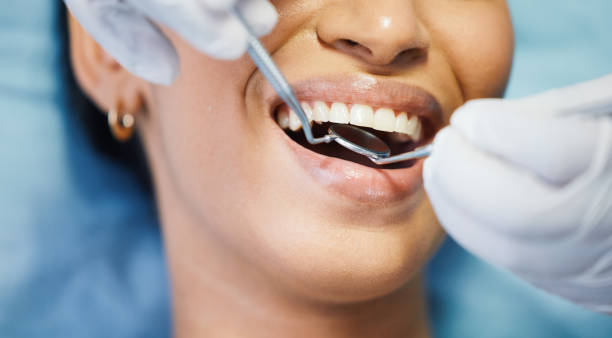 Best Emergency Dentist for Knocked-Out Tooth in Morris Plains, NJ