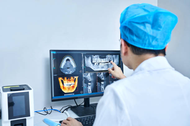 Best Emergency Dental Extractions in Morris Plains, NJ